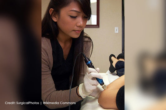 Microneedling for All Skin Types: What to Expect and How to Prepare