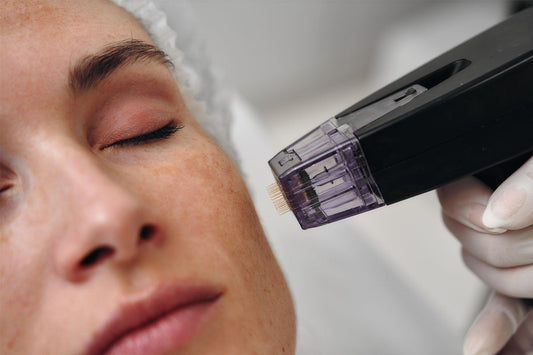 Turning Back the Clock: Microneedling for Anti-Aging