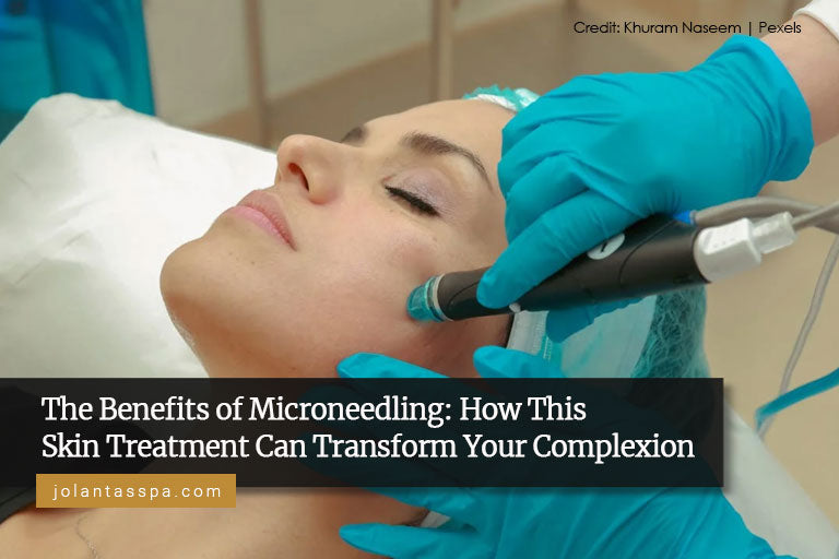 The Benefits of Microneedling: How This Skin Treatment Can Transform Your Complexion