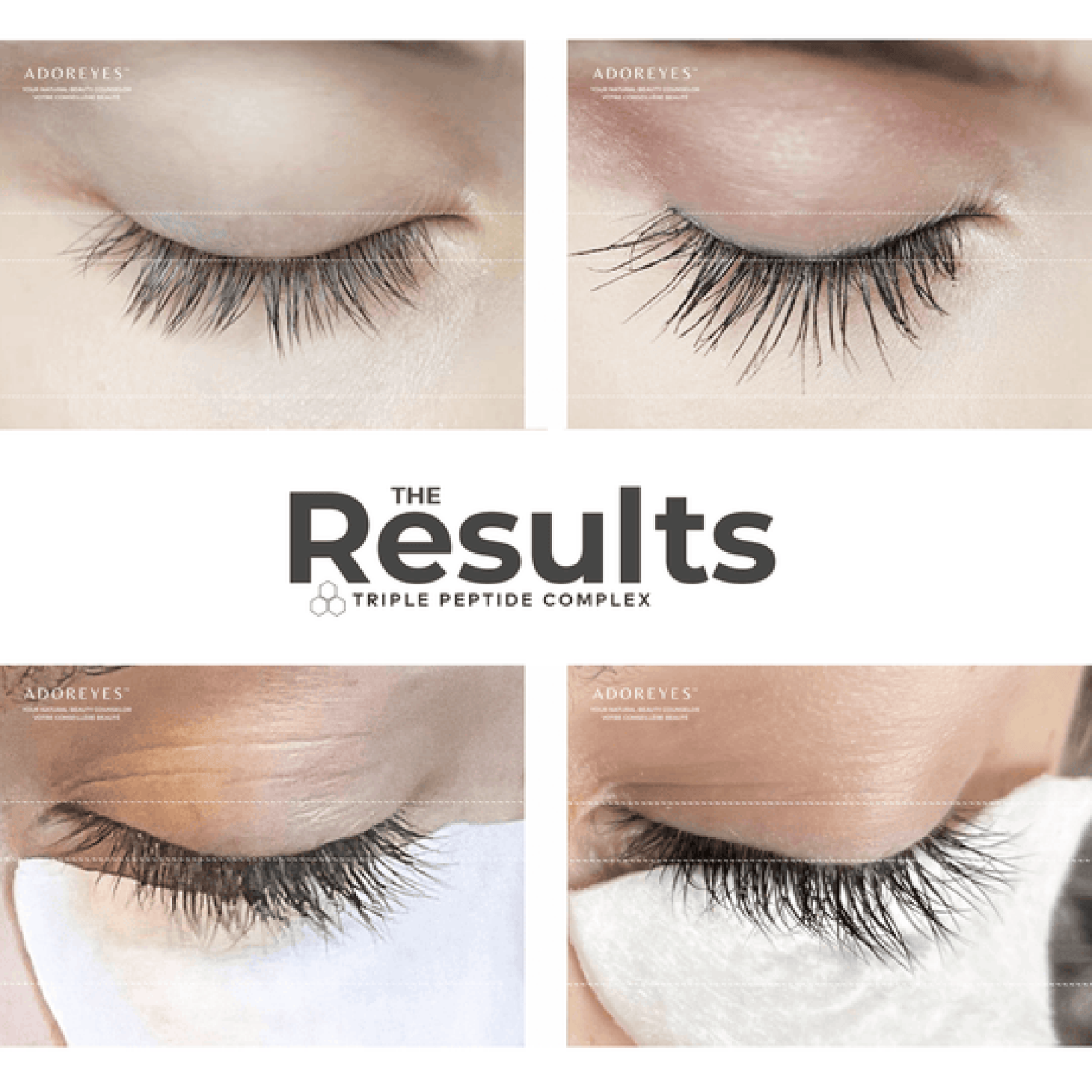 ADOREYES_Before_After_Results_3_Lashescopy_540x_13772bd2-5aec-44b4-a8ba-8bf043126a60