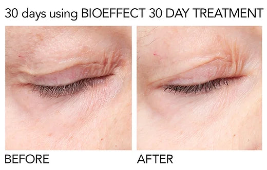 Bioeffect 30 Day Treatment 3 x 5ml